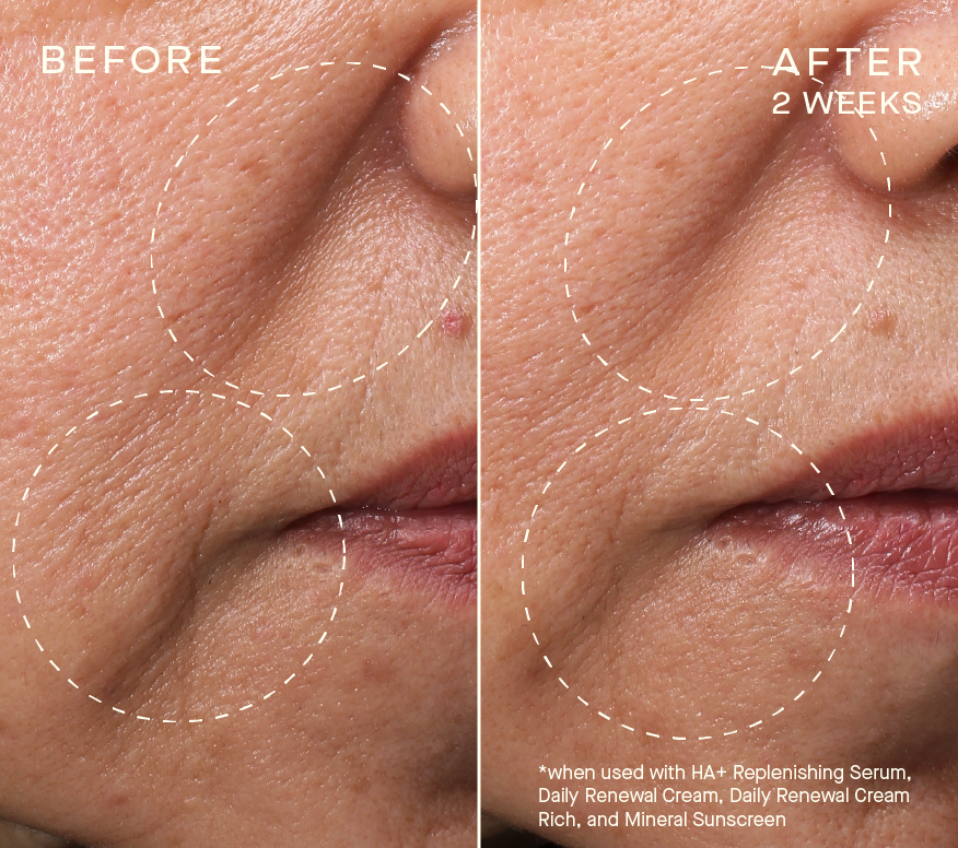 Advanced Regenerative Serum