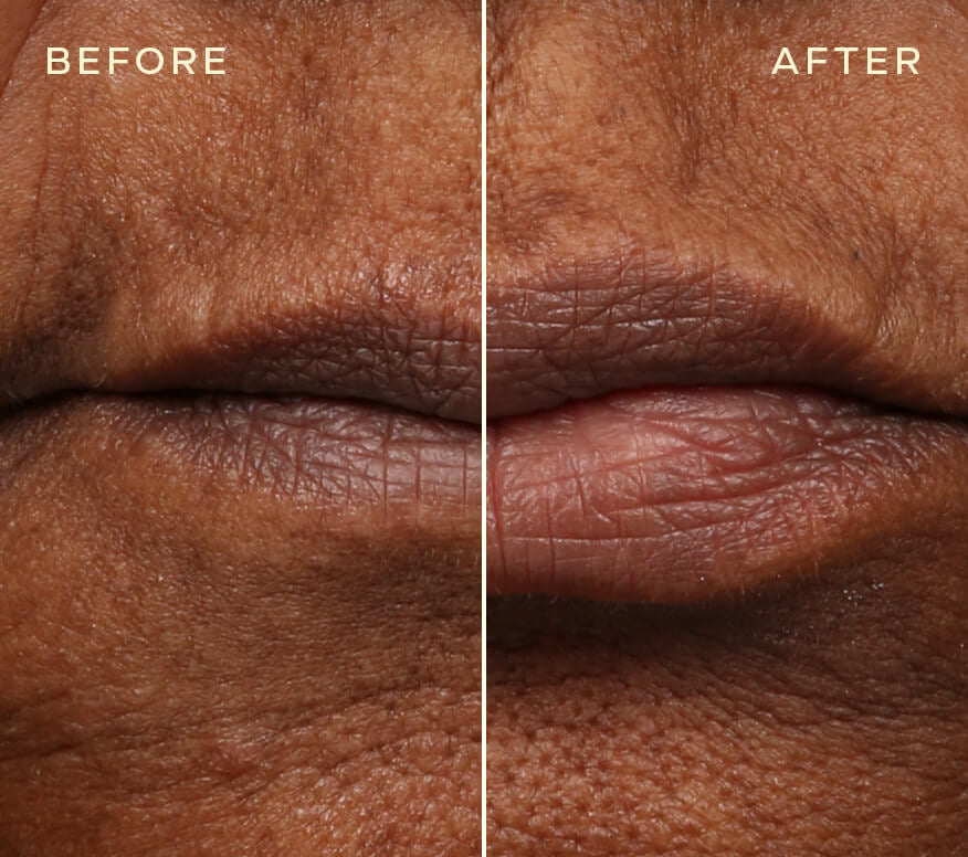 Replenishing Lip Filler